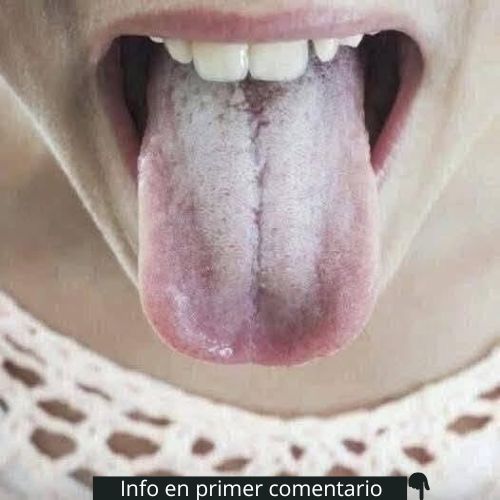 Lengua extendida que muestra diferentes colores