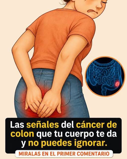 Cáncer de colon: señales tempranas, síntomas y cómo detectarlo a tiempo