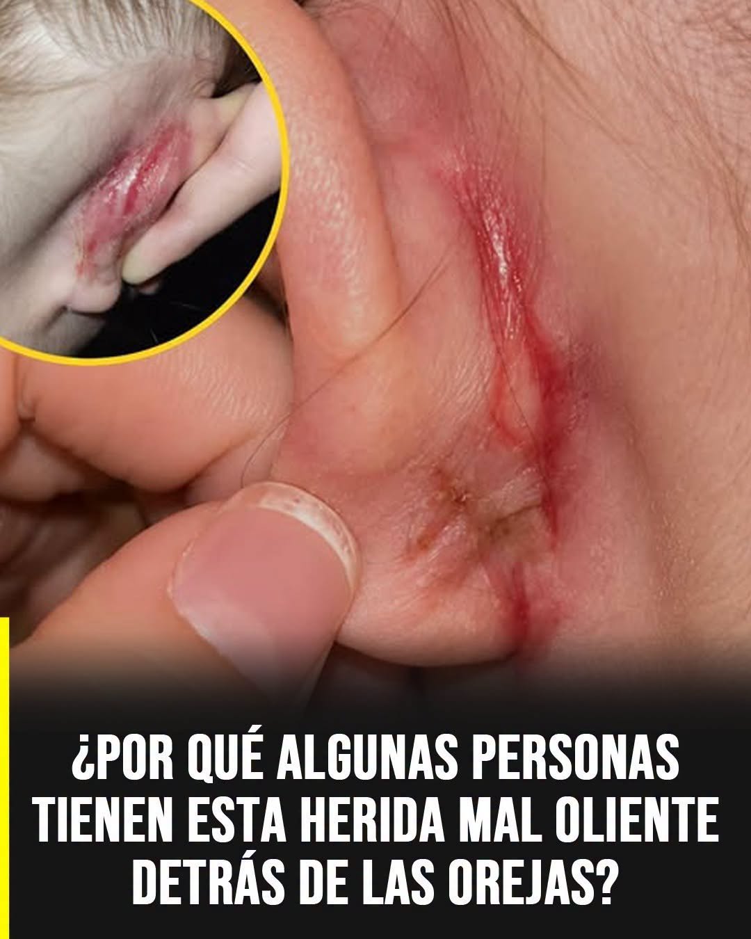 • Meta descripción: Descubre las causas de las costras con mal olor detrás de las orejas, sus síntomas, tratamientos y cuándo consultar al médico para evitar complicaciones.