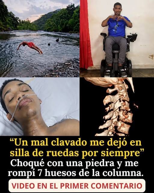 Título SEO: Lesión medular por golpe en el cuello: por qué un salto al agua puede ser irreversible